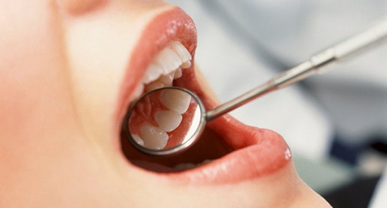 Chảy máu chân răng là bệnh gì (