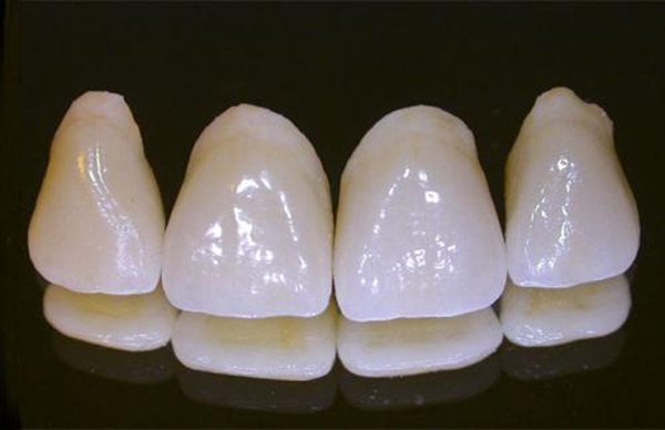 các loại răng sứ cao cấp