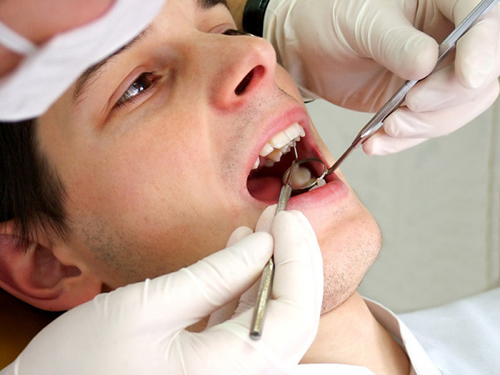 cấy ghép implant cho răng cửa
