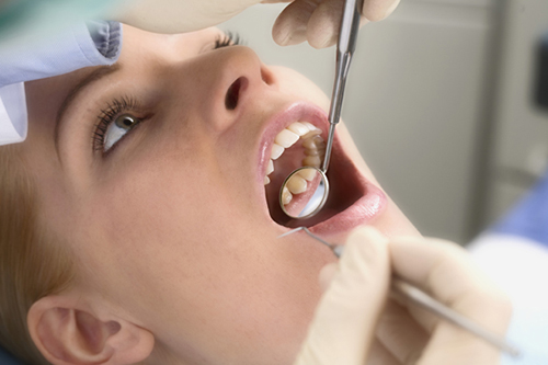 nhổ răng hàm không đau (