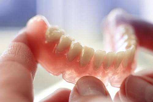 Trồng răng nhựa nguyên hàm cho người già 1