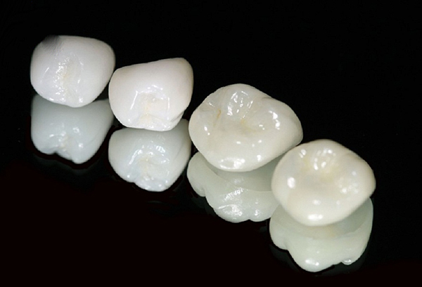 ưu và nhược điểm của răng sứ cercon