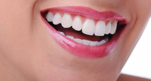 Phương pháp trồng răng implant giá bao nhiêu
