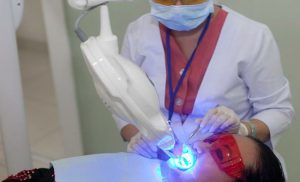 Phương pháp tẩy trắng răng bằng laser giá bao nhiêu? 1