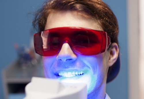 Quy trình tẩy trắng răng bằng laser tại phòng khám 2