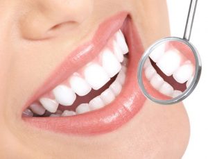 Tẩy trắng răng có an toàn không? 1